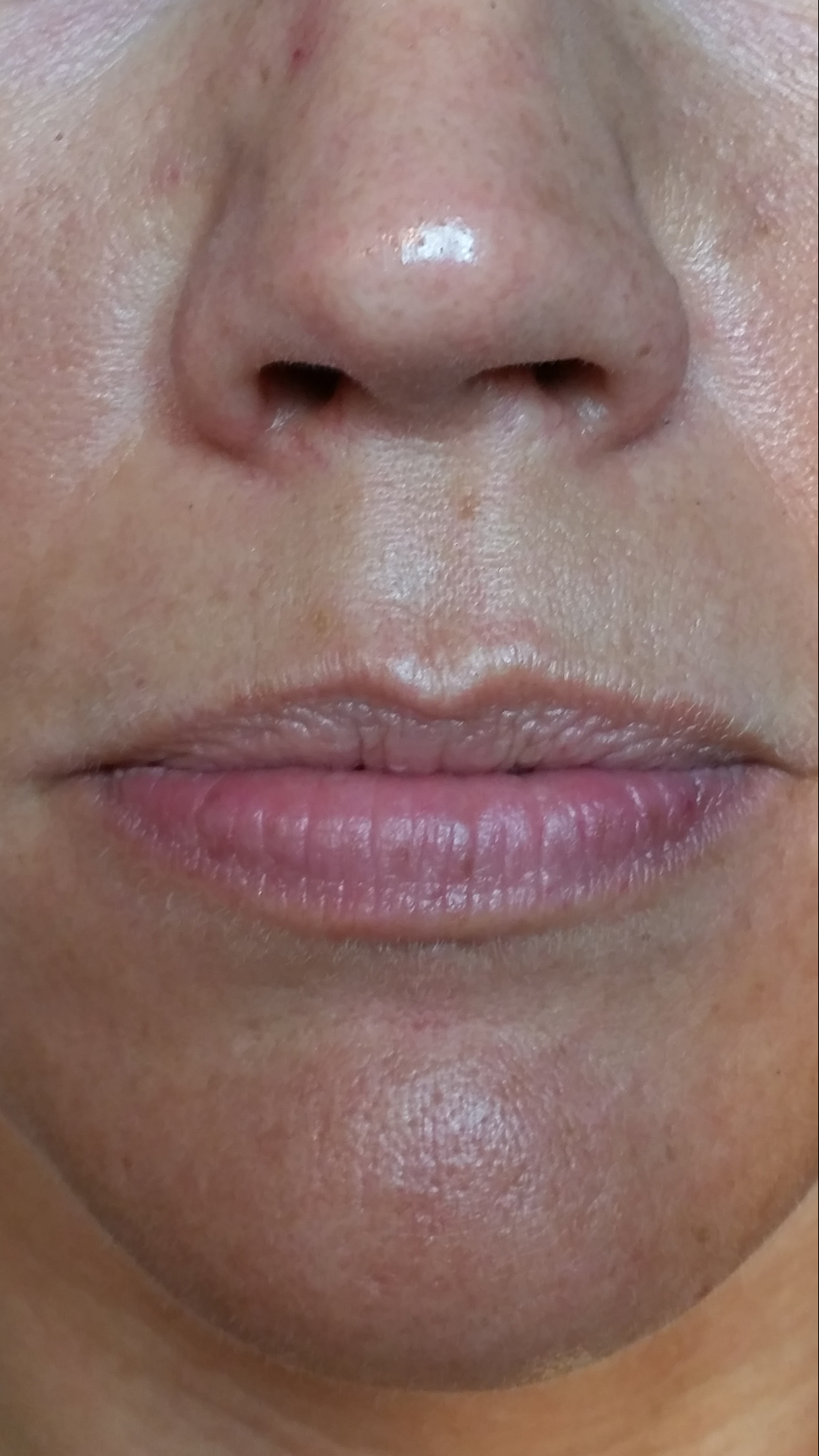 3-permanent-makeup-lips-before