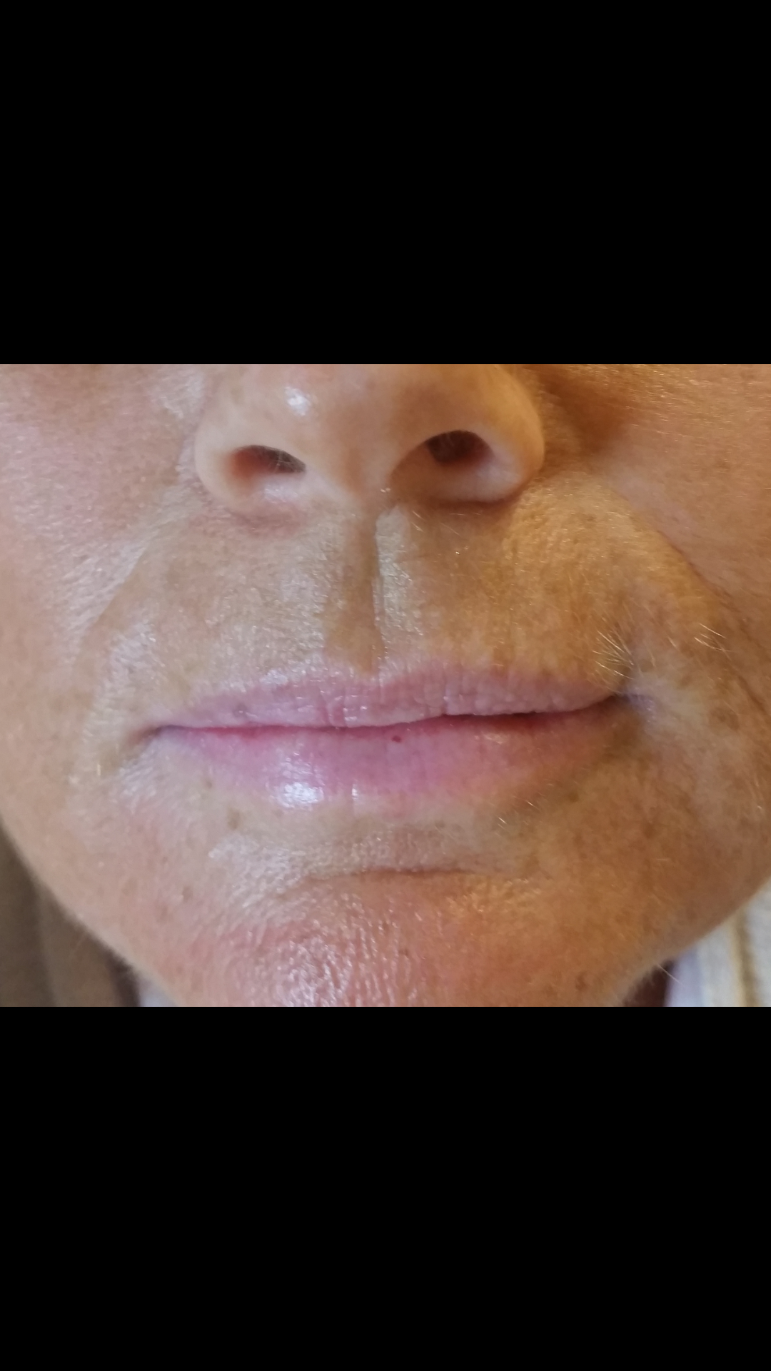 4-permanent-makeup-lips-before