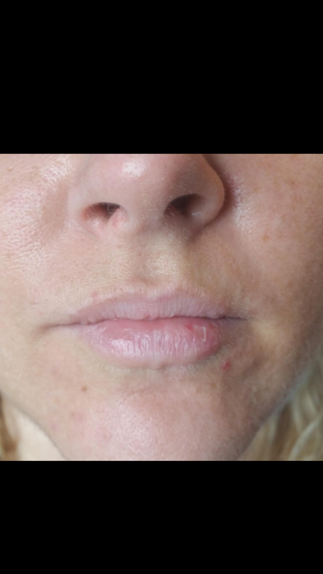 5-permanent-makeup-lips-before